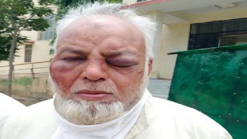 Muslim auto driver thrashed by history sheeters, communal angle unconfirmed