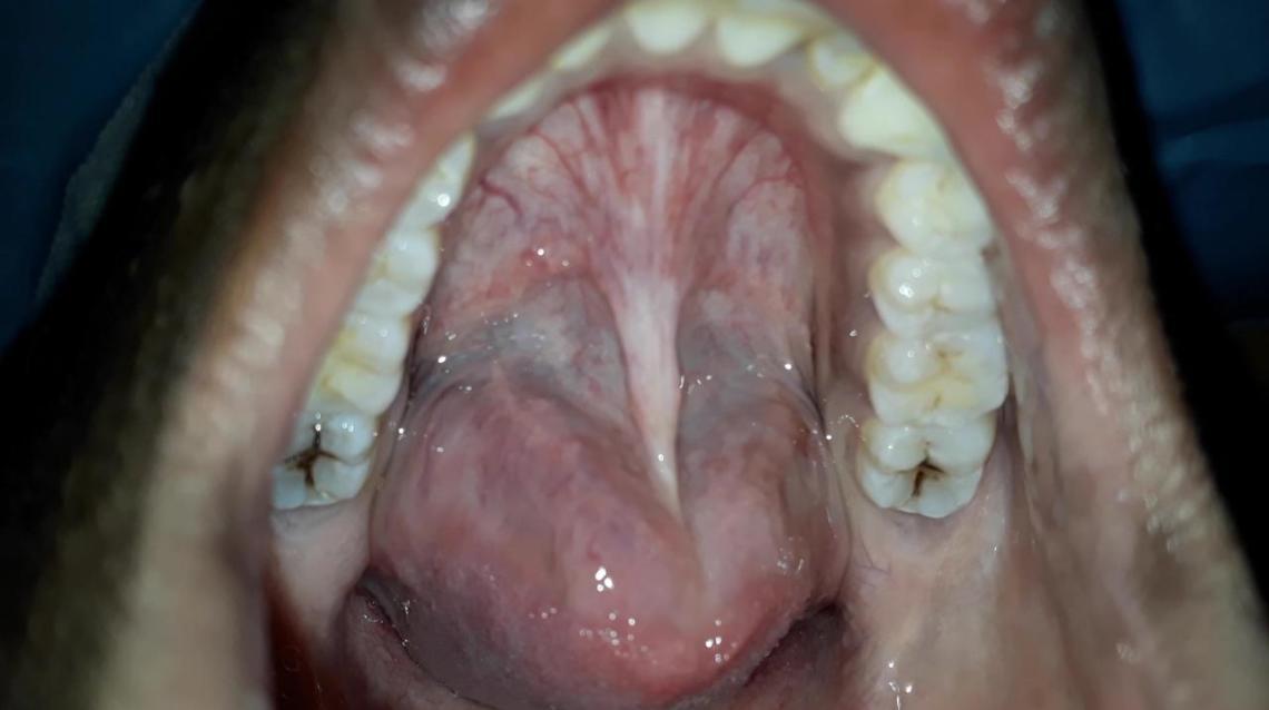 Find answers to health issues you can . Tongue Feels Heavy Sometimes Feel Like My Tongue Is Heavy And Practo Consult