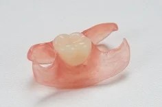 Partial Dentures For Upper Back Teeth Cost  : A Fixed Bridge Replaces One Or More Teeth By Placing.