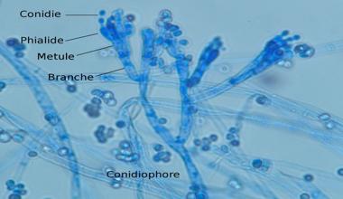 Plants, animals, fungi, and algae have cell walls. Describe the Vegetative Structure of Penicillium - QS Study