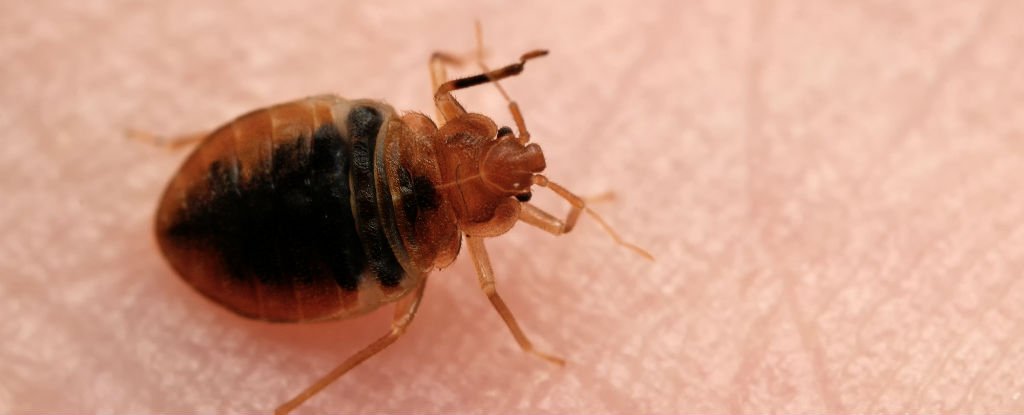 28+ Beautiful Do Bed Bugs Live In Hair : The sickest most infested Bed Bug job in Syracuse NY - YouTube - Don’t let the bed bugs bite.” but what if you do?