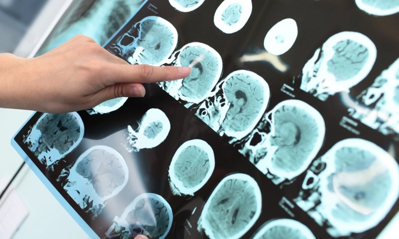 Artificial intelligence shows promise in diagnosing cognitive disorders Artificial intelligence shows promise in diagnosing cognitive disorders