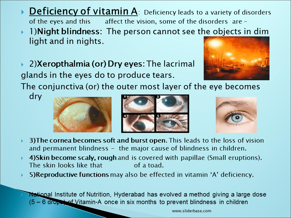24+ New Eye Disease Blindness / Contact Lens Horror Stories: Poor Care Can Lead to / Vision is an important part of our lives, yet the ability to see is something that many people take for granted.