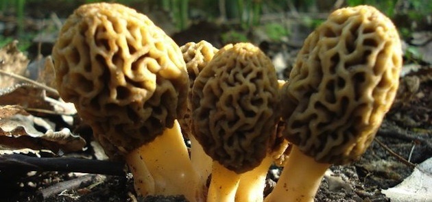 Morel Lavallee Lesions In The Ed St Emlyns Morel Lavallee Lesions In The Ed St Emlyns