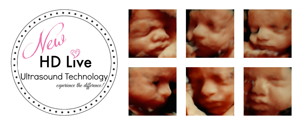 3d ultrasound, 4d ultrasounds, private ultrasound near me, . 3d Ultrasound Packages Tiny Hearts 3d