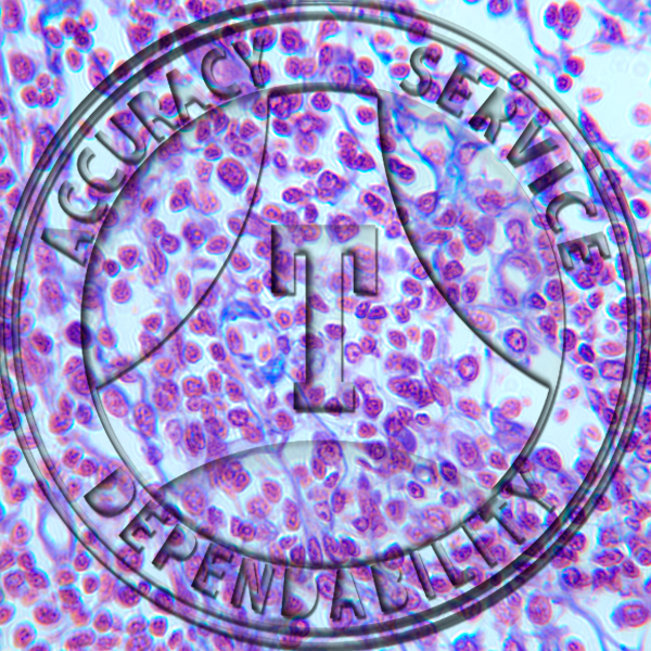 Reticular-Tissue-Slide---HB6-5----Reticular-tissue;-lymph-node,-section. Reticular Tissue Slide HB6-5 Reticular tissue; lymph node, section.