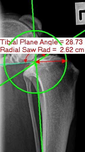 Things you buy through our links may earn us a co. TPLO Cruciate Surgery For Adelaide Dogs | Walkerville Vet