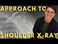 Shoulder X-ray interpretation | How to read a trauma shoulder X-ray