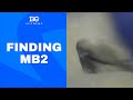 Finding MB2