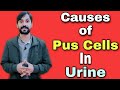 Causes of Pus Cells in Urine