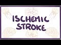 Ischemic Stroke - causes, symptoms, diagnosis, treatment, pathology