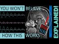 MRI Physics FULLY Explained! | MRI Physics Course Lecture 1