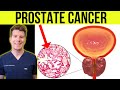 What is PROSTATE CANCER? Doctor explains SIGNS, SYMPTOMS, TREATMENT and more!
