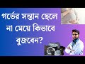 গর্ভের সন্তান ছেলে না মেয়ে বোঝার উপায়? ডাক্তারের পরামর্শ #healthtips