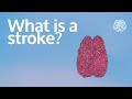 What is a stroke?