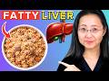 Fatty Liver? Top 10 Foods To Avoid