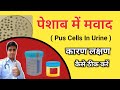 Pus Cells In Urine ! Causes Of Pus cells In Urine ! Pus Cells ! Urine Test,urine infection,पेशाब में