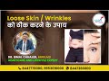 Loose Skin: Skin Tightening Home Remedies | Loose Skin से छुटकारा पाएं | SAAOL