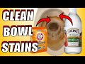 How to Clean Toilet Bowl Stains With Baking Soda \u0026 Vinegar