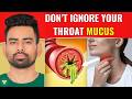How to Clear Excess Throat Mucus?