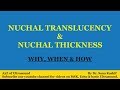 Nuchal Translucency \u0026 Nuchal Thickness- A2Z of Ultrasound