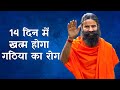 Arthritis will be cured in 14 days, watch Swami Ramdev's special class
