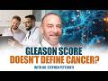 Is It Really Prostate Cancer? Rethinking Diagnosis, Biopsies, and the Gleason Score