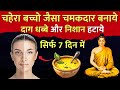 Buddhist Story To Clear Glowing Spotless Skin To Make Your Face Spotless And Beautiful