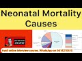 Neonatal mortality causes | Army medical corps interview | Ssc amc interview | Interview Guide