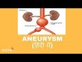 'ANEURYSM'  का हिंदी में अनुवाद। | 'ANEURYSM' MEANING EXPLAINED IN HINDI | VOCAB PLUS