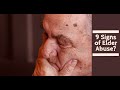 9 Signs of Elder Abuse