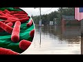 Diseases lurking in Hurricane Florence flood waters - TomoNews