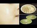 बेसन के इस्तेमाल से चेहरा गोरा, बेदाग बना देगा यह नुस्खा | चेहरे के कालेपन से छुटकारा | gharelu upay