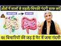 आँतों से चिपका मल निकालने का आसान तरीका 100 बिमारियों की जड़ है पेट में जमा गंदगी,Detox your colon