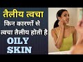 तैलीय त्वचा किन कारणों से होती है? || Oily skin causes in Hindi || MedHealth Support