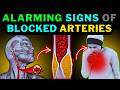 Silent Signs of Artery Blockages You Can’t Ignore