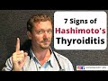 HASHIMOTO'S THYROIDITIS (7 Secret Signs You Should Know) 2024