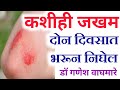 जखम लवकर बरी होण्यासाठी उपाय | जखम कशी बरी करावी | Uses Of Calendula Homeopathy Ointment