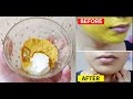 चेहरा इतना गोरा साफ खूबसूरत कर देगा ये नुस्खा दुनिया देखती रह जाएगी | skin whitening | glowing skin