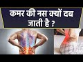 कमर की नस दबने के लक्षण | कमर की नस क्यों दब जाती है | Boldsky *health