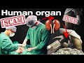 भारत में अवैध मानव अंग तस्करी 💰 | @doctorduo