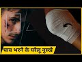 घाव भरने के घरेलू नुस्खे | @GharkeNuskhhe #trending #viral #gharkenuske