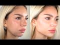 experimental facial sculpting and definition — 1X MAX!