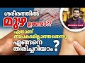 2223: മുഴ ഉണ്ടോ? എങ്ങനെ തിരിച്ചറിയാം?  | Red Flags Explained