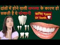 दांतों में होने वाली समस्या के कारण हो सकती है ये परेशानी| जानिए Types Of Teeth