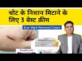 शरीर पर निशान (Scar Mark) के लिए बेस्ट 3 क्रीम का नाम | Best Scar Mark Removal Cream
