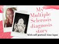 My MS diagnosis diagnosis story - Time lapse of migraine self portrait.