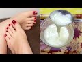 पैरो में सालों साल जमी मैल गंदगी बदबू मिनटों में साफ कर गोरा बनाए | FEET WHITENING BLEACH At Home