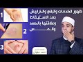 علاقة الكدمات والبقع الزرقاء والخرابيش على الجسم بالسحر والحسد وكيفية العلاج | أحمد علوان