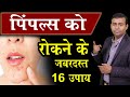 16 amazing ways to prevent pimples. How to remove pimples | Acne Treatment in Hindi